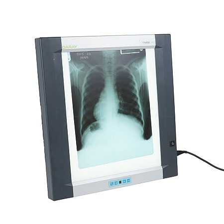  X-Ray Light Box Viewer